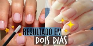 acelerar o crescimento das unhas