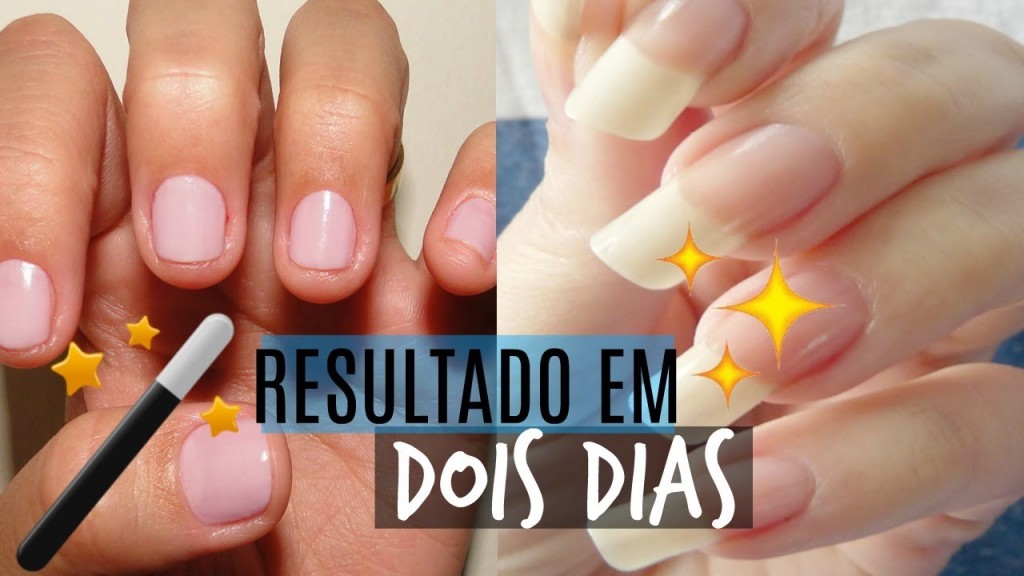 acelerar o crescimento das unhas