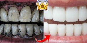 dicas de como clarear os dentes naturalmente