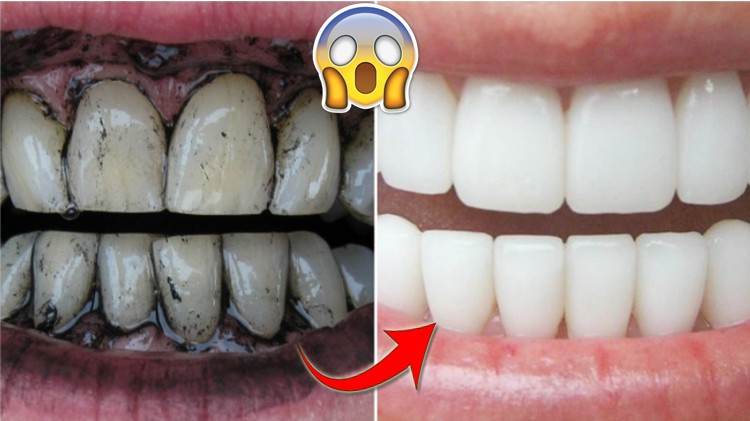 dicas de como clarear os dentes naturalmente