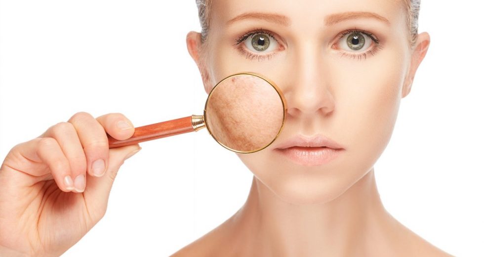 10 receitas caseiras para combater o melasma: como fazer e usar