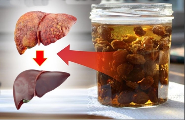 Como tratar e curar o fígado gordo com estes 11 alimentos