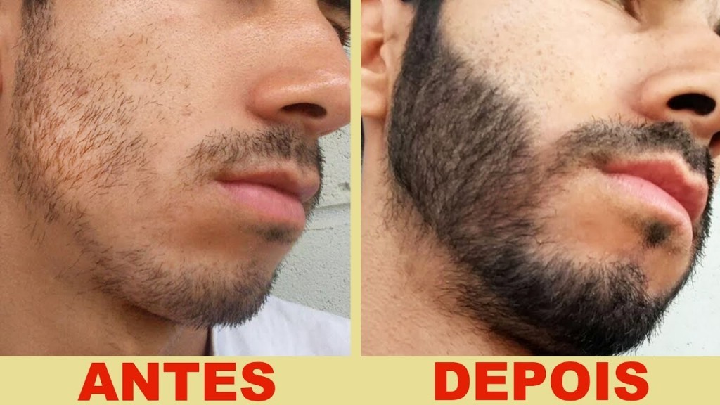 remedios caseiros para ajudar barba crescer