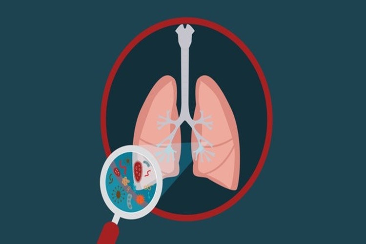 remédios caseiros para bronquite