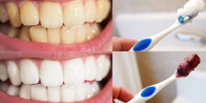 dicas naturais para clarear os dentes em casa