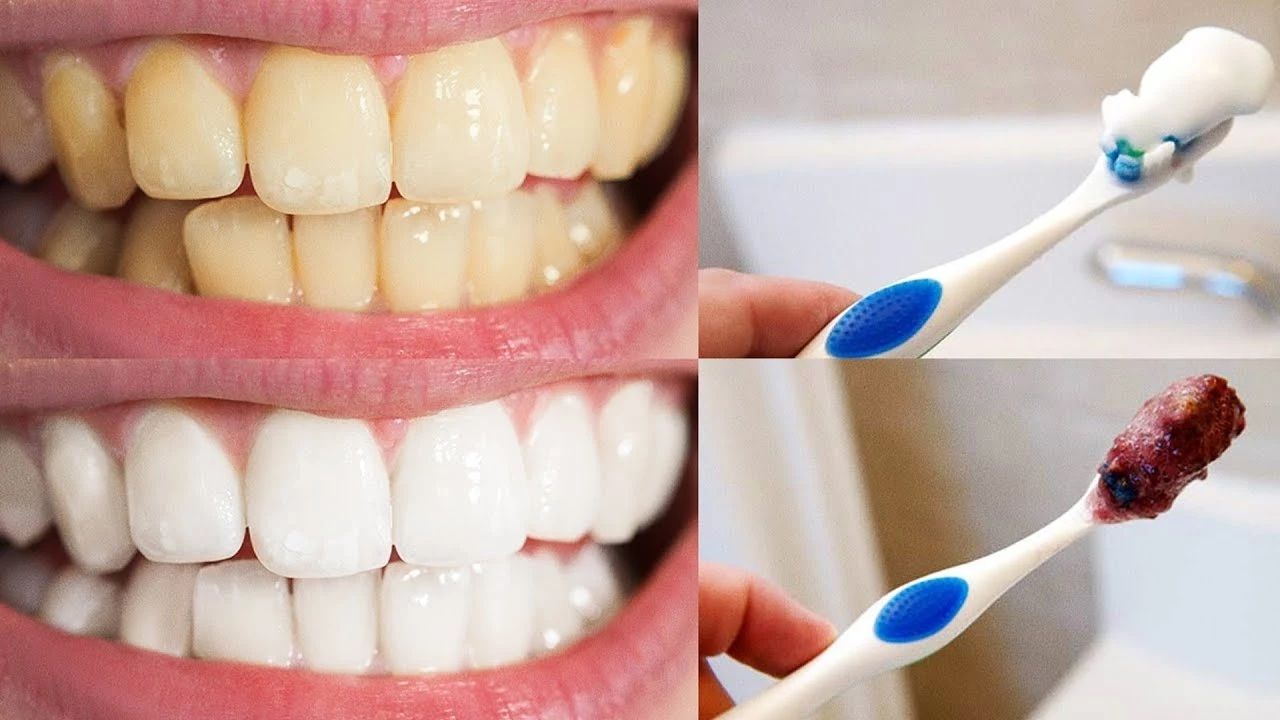 dicas naturais para clarear os dentes em casa