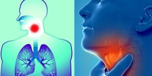 quais as causas da tosse?