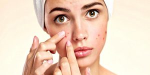 pepino para eliminar acne em casa