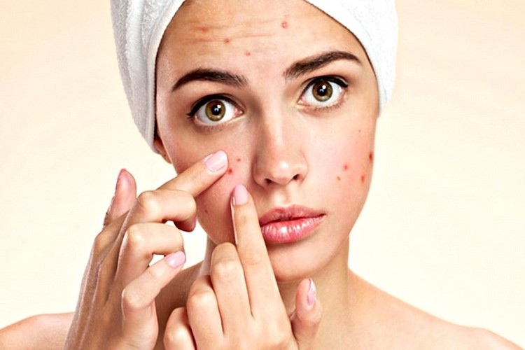 pepino para eliminar acne em casa