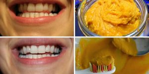 curcuma para clarear os dentes sem sair de casa