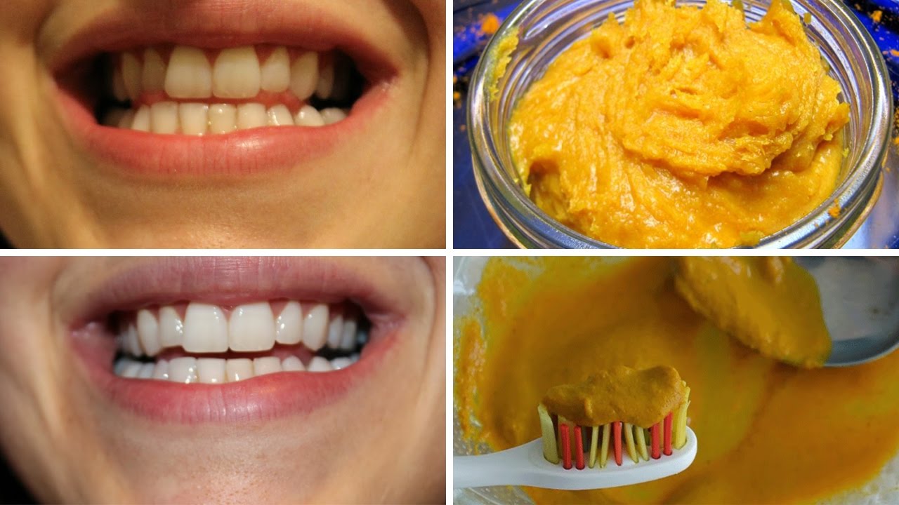 curcuma para clarear os dentes sem sair de casa