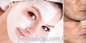 máscara caseira para tratar problemas de pele