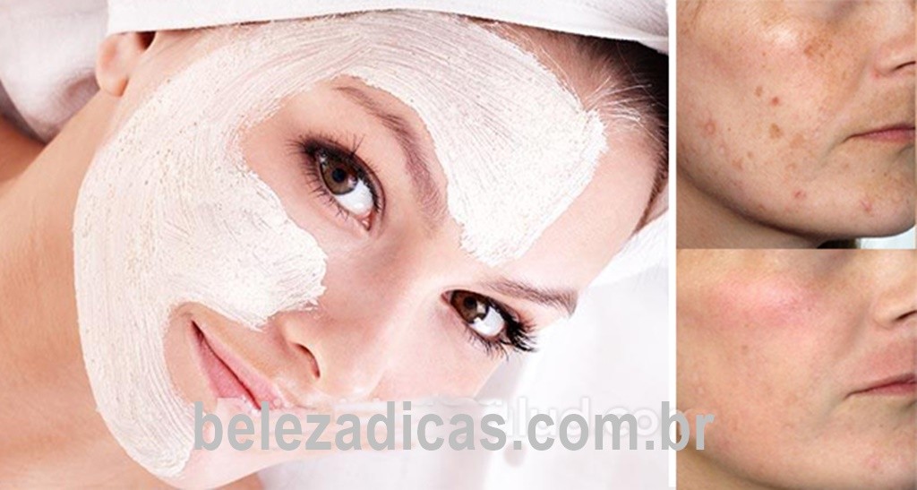 máscara caseira para tratar problemas de pele