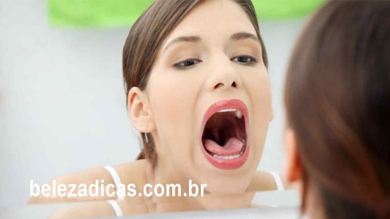 Tratamentos Naturais Para Aliviar Bolhas na Língua