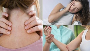 sintomas de leucemia
