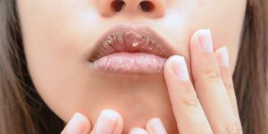 dicas faceis para clarear labios escuros