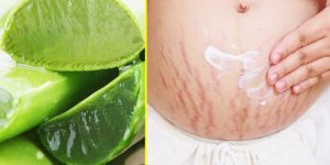 receitas com aloe vera para eliminar estrias