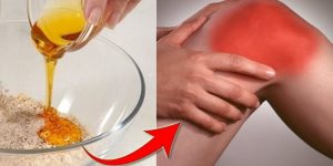 melhores analgesicos naturais para aliviar a dor