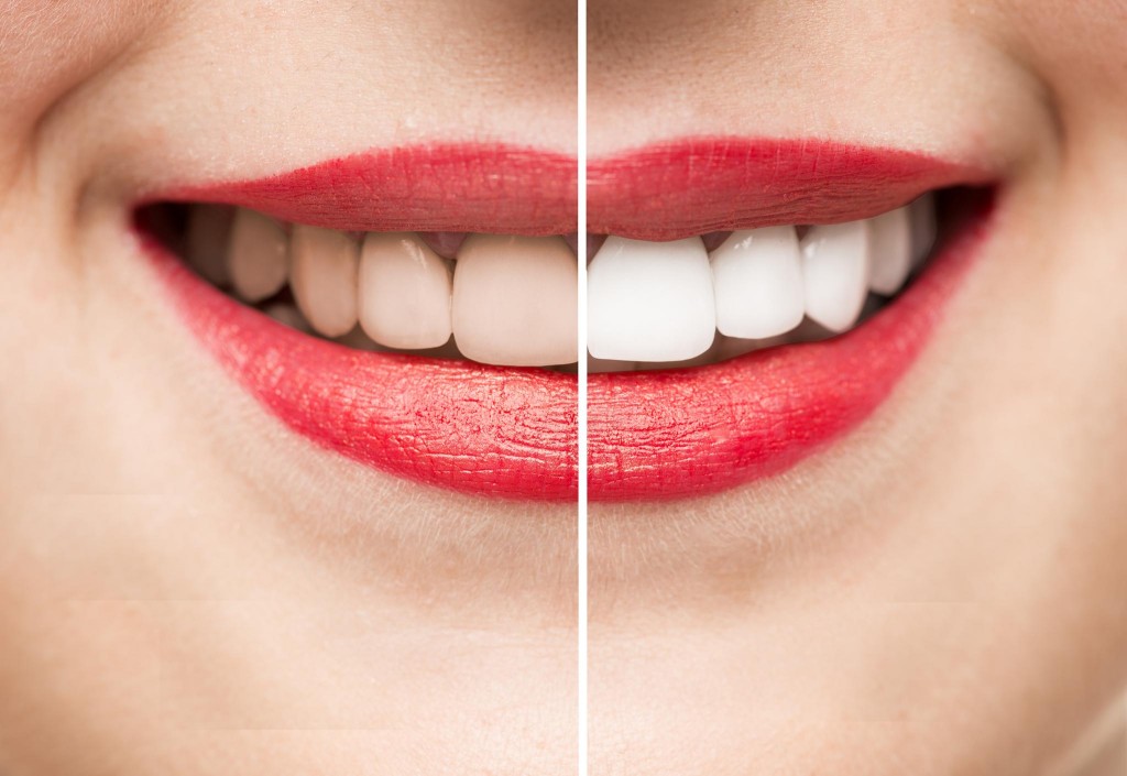 Casca de banana ajuda a clarear os dentes, elimina espinhas: veja os 7 benefícios
