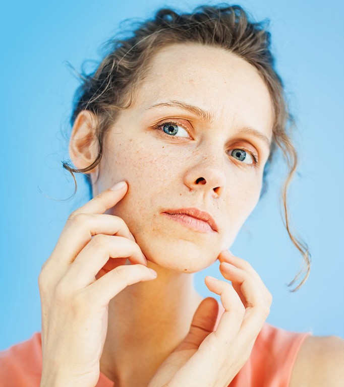 Infecções fúngicas faciais: quais as causas, os sintomas e tratamentos