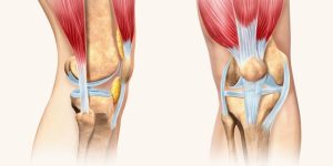 fortalecer os tendões e ligamentos