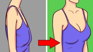 Receita-Acaba-com-a-Flacidez-nos-Seios