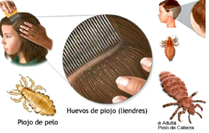 remédio natural para eliminar piolhos e fungos