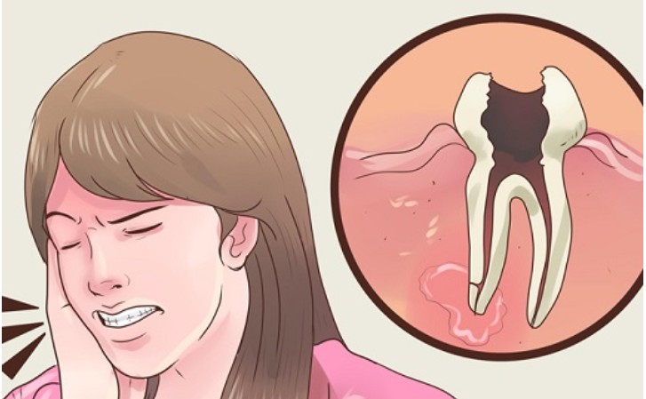 remédios para aliviar dores de dente e infecções dentárias