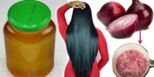 cebola para queda de cabelo