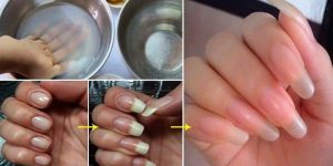 soro caseiro para o crescer as unhas