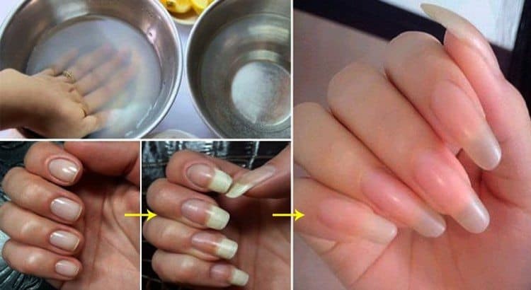 soro caseiro para o crescer as unhas