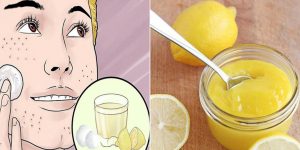 limão para remover as manchas do rosto