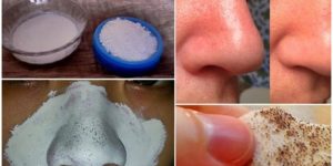 receita caseira para remover cravos do nariz