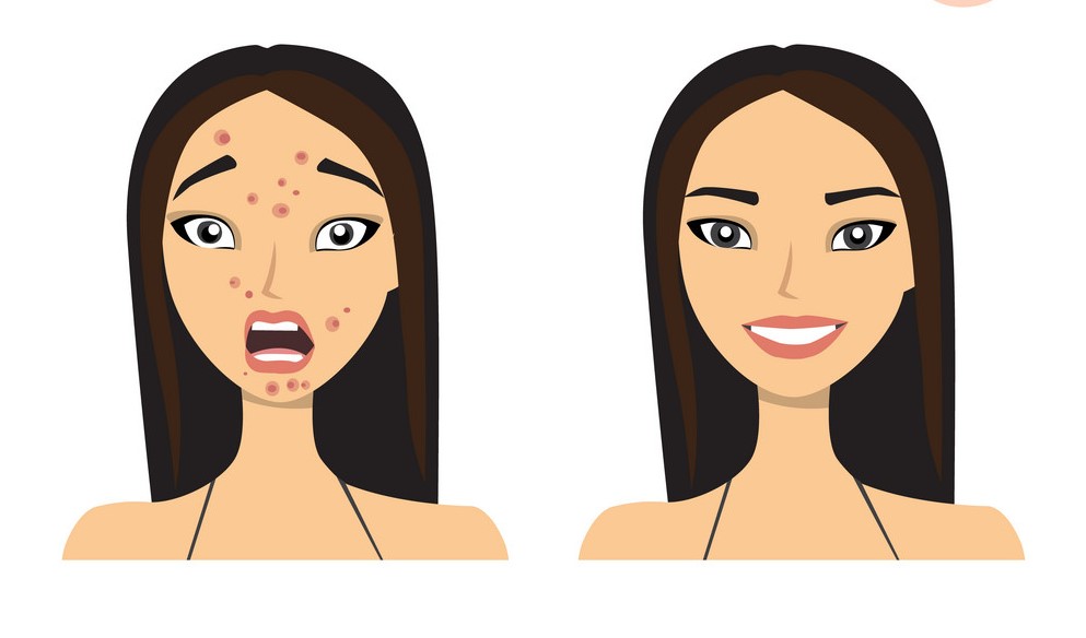 10 cuidados com a pele do rosto: como fazer, dicas e receitas caseiras