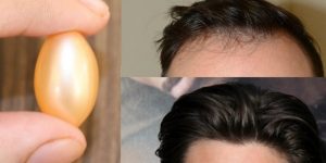 melhores vitaminas para o cabelo crescer (2)